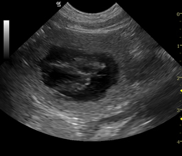 ultrasound1