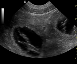 ultrasound2