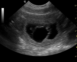 ultrasound4